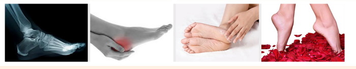 FitoHeel (Фито Хил) крем от пяточной шпоры